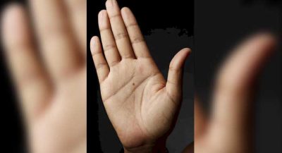 hand-palm