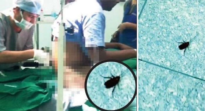 doctor-halts-surgery-to-film-cockroach-in-thane-civic-hospitals-operation-theatre-mumbai