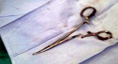 scissors-left-inside-mans-stomach-during-surgery-pulled-out-after-18-years