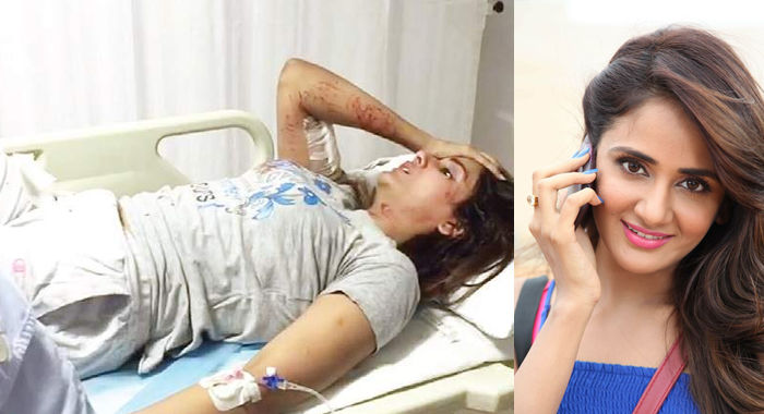 pack-of-six-stray-dogs-attack-kannada-actress-parul