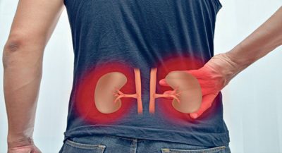 the most effective natural remedy for melting kidney stones