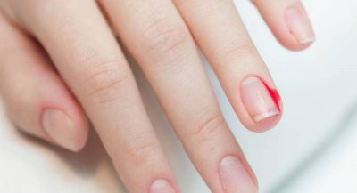 ever-thought-why-some-people-bite-nails3