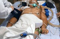 brain-death-and-organ-transplantation-mafia