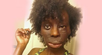 burns-victim-refuses-surgery-because-she-loves-her-scars1