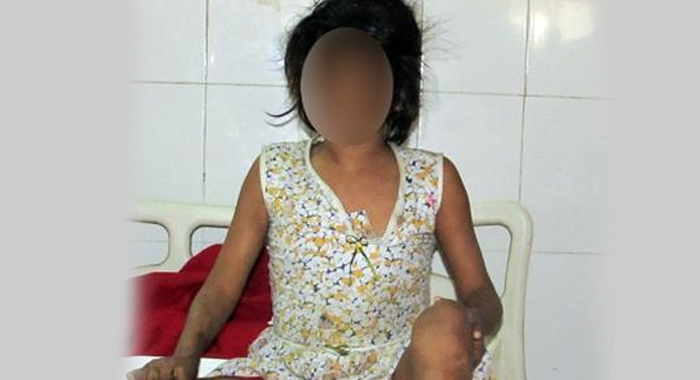 eight-year-old-girl-found-living-with-monkeys