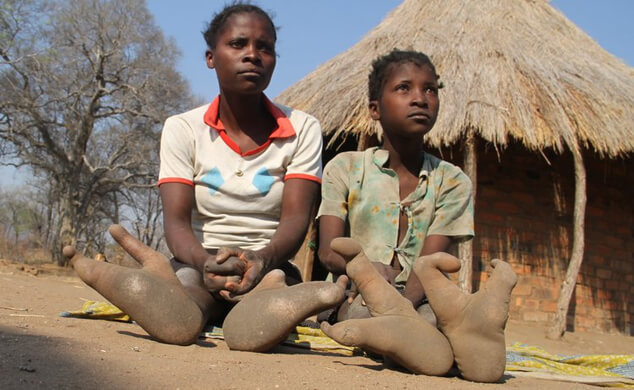feature-the-ostrich-people-of-zimbabwe