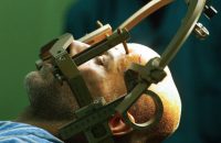 bengaluru-man-plays-guitar-as-docs-operate-on-his-brain