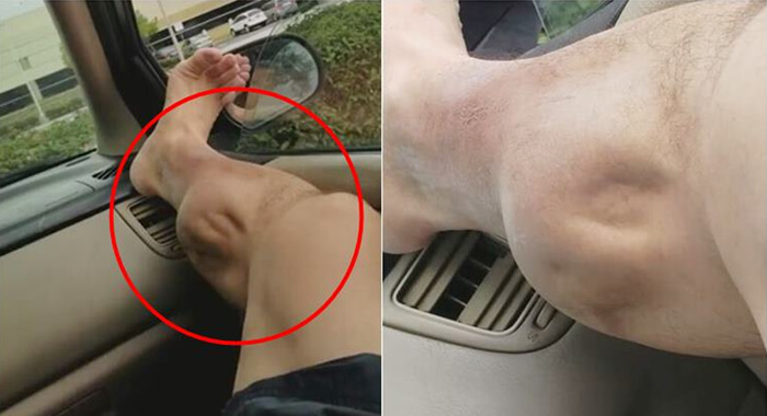 watch-this-scary-post-workout-cramp-video