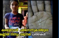 indian-girl-allegedly-has-cotton-tears-oozing-from-her-eyes-every-day