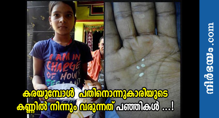 indian-girl-allegedly-has-cotton-tears-oozing-from-her-eyes-every-day