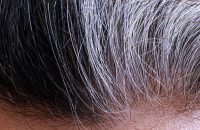 remedies-to-stop-premature-graying-of-hair