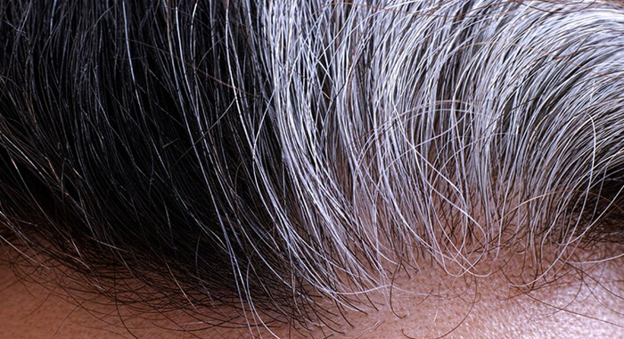 remedies-to-stop-premature-graying-of-hair