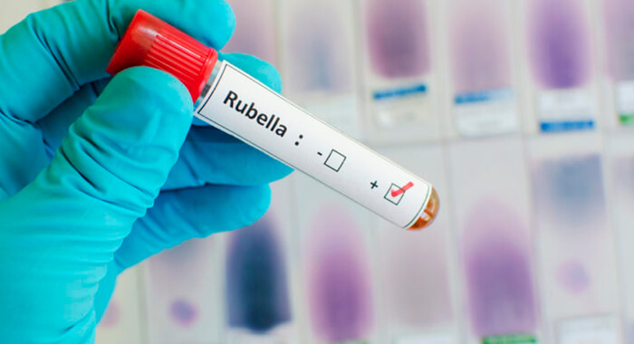 rubella-vaccination-interrupted-in-calicut
