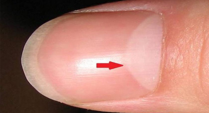 do-you-know-what-the-half-moon-shape-on-your-nnails-means