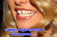gap-between-front-teeth