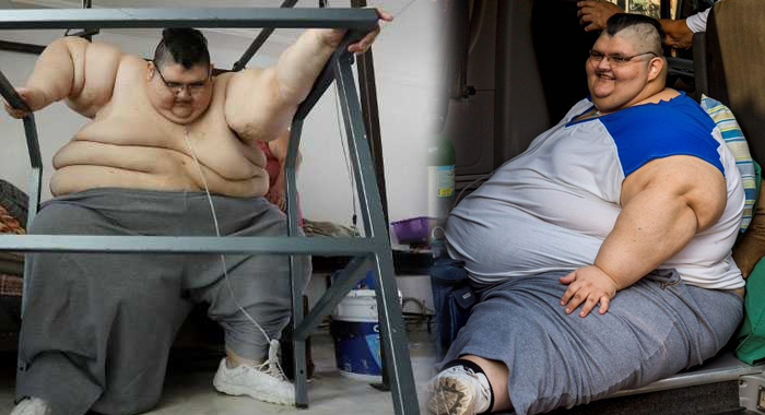 mexican-man-once-the-worlds-fattest-dreams-of-walking-again