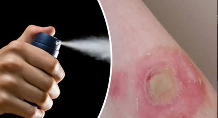 deodorant-challenge-causes-young-people