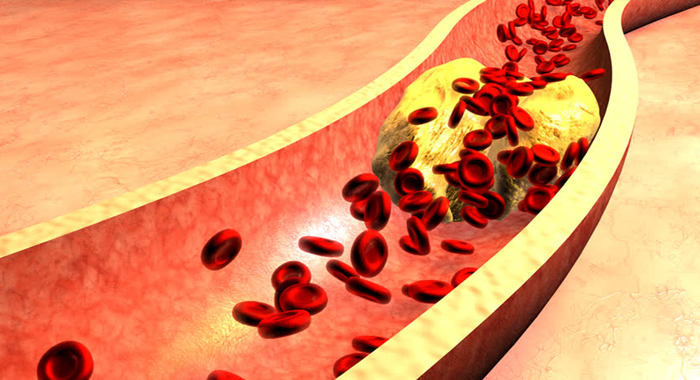 tips-to-reduce-cholesterol