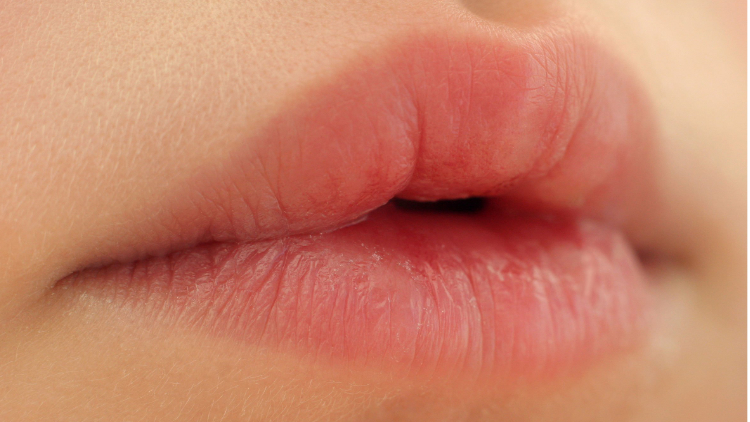 how-to-protect-our-lips