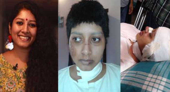 anumol-malayalam-actress-makeover-pictures