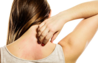 remedies-skin-allergy