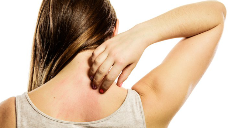 remedies-skin-allergy