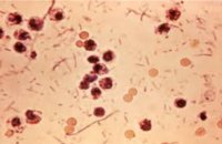 shigella-bacteria-infection-signs-and-symptoms
