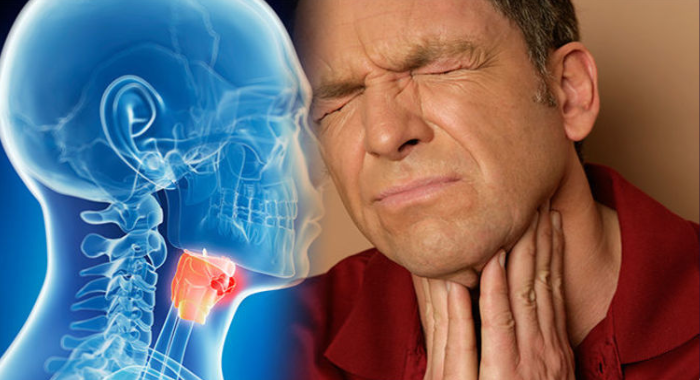 symptoms-of-throat-cancer-you-should-know