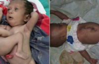 baby-born-after-the-first-ever-womb-transplant-from-a-dead-donor