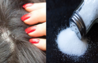how-to-get-rid-of-dandruff-with-natural-remedies