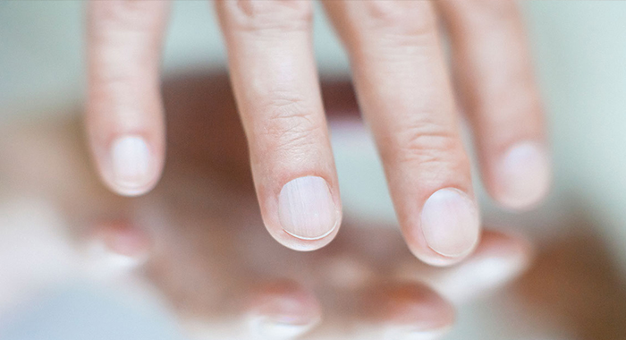 nail-symptoms-liver-disease
