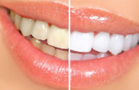 allspice-for-mouth-odor-and-teeth-stain