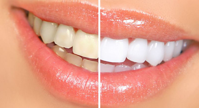 allspice-for-mouth-odor-and-teeth-stain