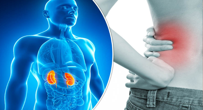 best-ayurveda-remedies-for-kidney-stone