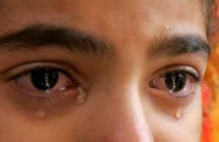 watery-eyes-symptoms-causes-treatment