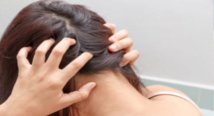 lice-in-hair-and-solution