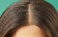 hair-care-get-rid-of-dandruff