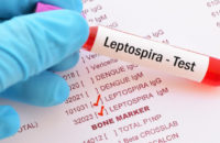 leptospirosis-causes-symptoms-treatment-and-prevention