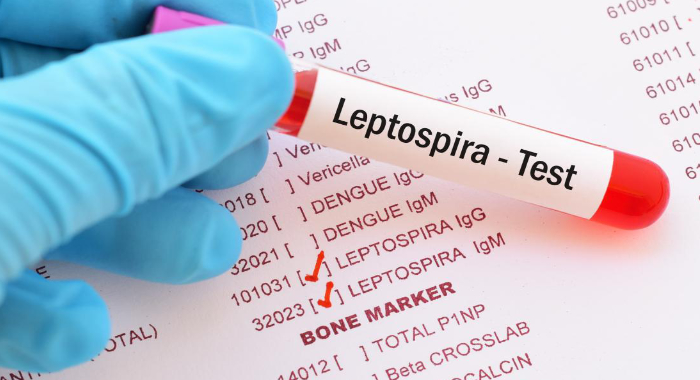 leptospirosis-causes-symptoms-treatment-and-prevention
